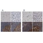 CDV3 Antibody in Immunohistochemistry (IHC)
