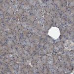 CDV3 Antibody in Immunohistochemistry (IHC)