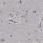 CDV3 Antibody in Immunohistochemistry (IHC)