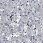 CDV3 Antibody in Immunohistochemistry (IHC)