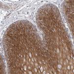 GPSN2 Polyclonal Antibody