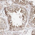 C6orf118 Polyclonal Antibody