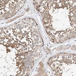 C6orf118 Polyclonal Antibody