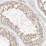 FAM54A Antibody in Immunohistochemistry (IHC)