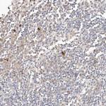 FAM54A Polyclonal Antibody