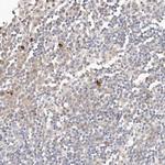 FAM54A Antibody in Immunohistochemistry (IHC)