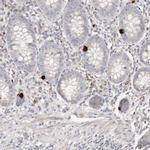 FAM54A Antibody in Immunohistochemistry (IHC)