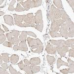 FAM54A Antibody in Immunohistochemistry (IHC)
