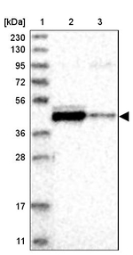 FAM54A Antibody in Western Blot (WB)