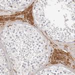 FAM54A Polyclonal Antibody