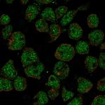 TTC24 Polyclonal Antibody