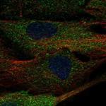 ALPK2 Antibody in Immunocytochemistry (ICC/IF)