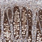 ALPK2 Antibody in Immunohistochemistry (Paraffin) (IHC (P))