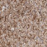 HAUS4 Polyclonal Antibody