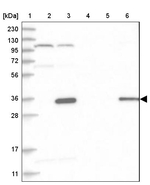HAUS4 Antibody in Western Blot (WB)