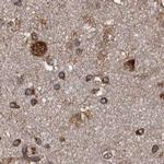 DARS Antibody in Immunohistochemistry (IHC)