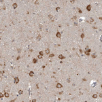 DARS Polyclonal Antibody