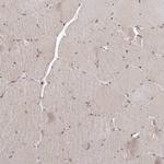 GADD45B Antibody in Immunohistochemistry (IHC)