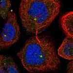 TTI2 Polyclonal Antibody