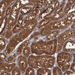 TTI2 Antibody in Immunohistochemistry (Paraffin) (IHC (P))
