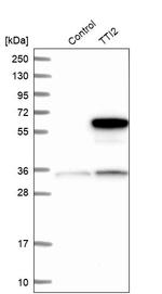 TTI2 Antibody in Western Blot (WB)