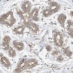 CAGE1 Polyclonal Antibody