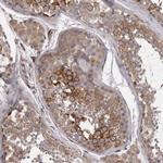 PNRC1 Polyclonal Antibody