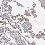 PNRC1 Antibody in Immunohistochemistry (IHC)