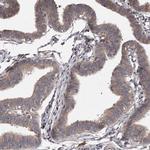 PNRC1 Antibody in Immunohistochemistry (IHC)