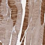 PNRC1 Antibody in Immunohistochemistry (IHC)