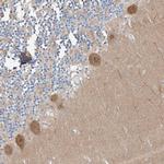 CLDND1 Antibody in Immunohistochemistry (Paraffin) (IHC (P))