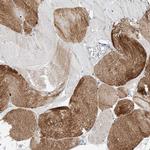 CLDND1 Antibody in Immunohistochemistry (Paraffin) (IHC (P))