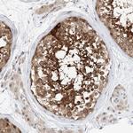 CLDND1 Antibody in Immunohistochemistry (Paraffin) (IHC (P))