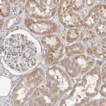 SLC25A20 Antibody in Immunohistochemistry (Paraffin) (IHC (P))