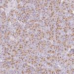 KIAA1324 Antibody in Immunohistochemistry (IHC)
