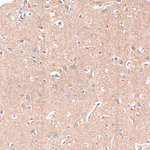 NKAIN4 Polyclonal Antibody