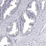 NKAIN4 Antibody in Immunohistochemistry (Paraffin) (IHC (P))