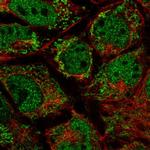 MRPL10 Polyclonal Antibody