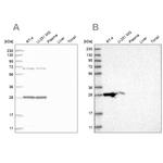 MRPL10 Antibody in Western Blot (WB)