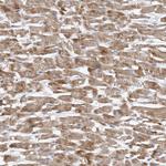 PGBD2 Antibody in Immunohistochemistry (Paraffin) (IHC (P))