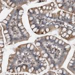 PGBD2 Antibody in Immunohistochemistry (Paraffin) (IHC (P))