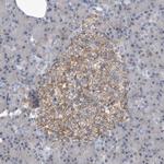 PGBD2 Polyclonal Antibody