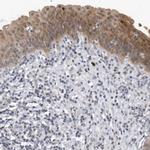 PGBD2 Antibody in Immunohistochemistry (IHC)