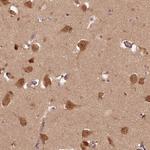 PRNPIP Antibody in Immunohistochemistry (Paraffin) (IHC (P))