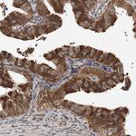 PMVK Antibody in Immunohistochemistry (Paraffin) (IHC (P))