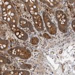 PMVK Antibody in Immunohistochemistry (Paraffin) (IHC (P))