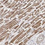 PMVK Antibody in Immunohistochemistry (Paraffin) (IHC (P))