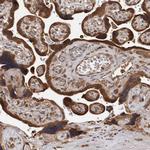 PMVK Antibody in Immunohistochemistry (Paraffin) (IHC (P))