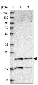 PMVK Antibody in Western Blot (WB)