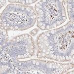 STKLD1 Polyclonal Antibody